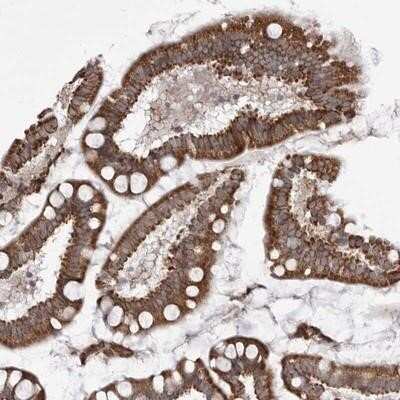 Immunohistochemistry-Paraffin: TMPRSS11F Antibody [NBP1-94000]