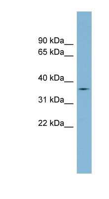 Western Blot: TMPRSS12 Antibody [NBP1-91466]