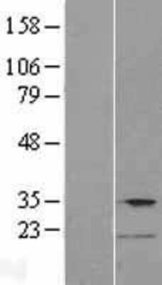 Western Blot: TMPRSS12 Overexpression Lysate [NBP2-04847]