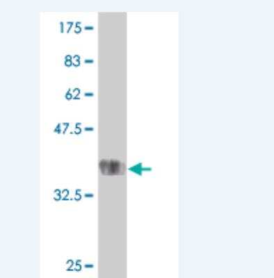 Western Blot: TMPRSS13 Antibody (4F7) [H00084000-M01]