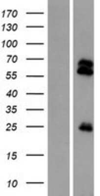 Western Blot: TMPRSS13 Overexpression Lysate [NBP2-08451]