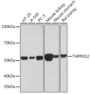 Western Blot: TMPRSS2 Antibody (7B9W3) [NBP3-00492]