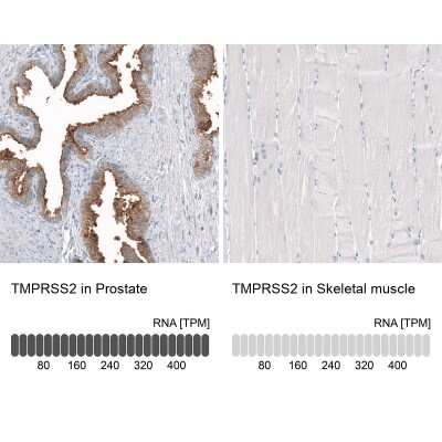 Immunohistochemistry-Paraffin: TMPRSS2 Antibody (CL12512) [NBP3-18573]