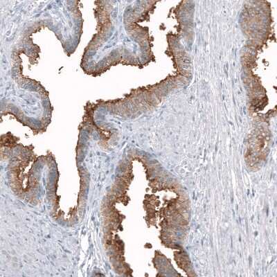 Immunohistochemistry-Paraffin: TMPRSS2 Antibody (CL12512) [NBP3-18573]
