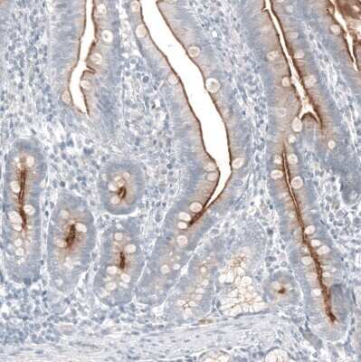 Immunohistochemistry-Paraffin: TMPRSS2 Antibody (CL12512) [NBP3-18573]