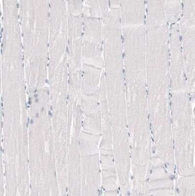 Immunohistochemistry-Paraffin: TMPRSS2 Antibody (CL12512) [NBP3-18573]