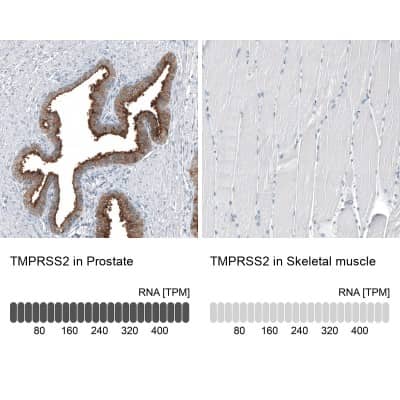 Immunohistochemistry-Paraffin: TMPRSS2 Antibody (CL12511) [NBP3-18579]