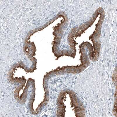 Immunohistochemistry-Paraffin: TMPRSS2 Antibody (CL12511) [NBP3-18579]