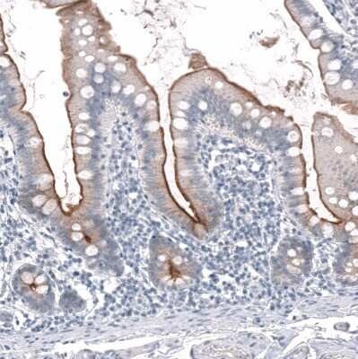 Immunohistochemistry-Paraffin: TMPRSS2 Antibody (CL12511) [NBP3-18579]