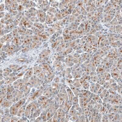 Immunohistochemistry-Paraffin: TMPRSS2 Antibody (CL12511) [NBP3-18579]