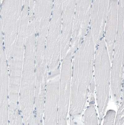Immunohistochemistry-Paraffin: TMPRSS2 Antibody (CL12511) [NBP3-18579]