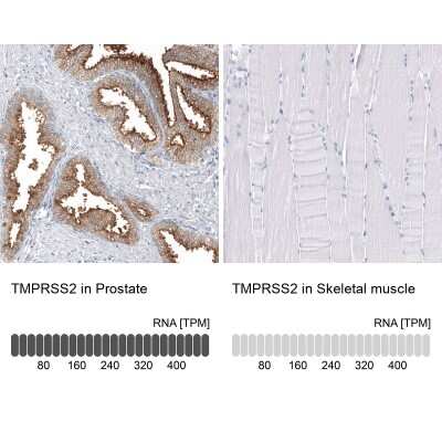 Immunohistochemistry-Paraffin: TMPRSS2 Antibody (CL12514) [NBP3-18539]