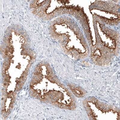 Immunohistochemistry-Paraffin: TMPRSS2 Antibody (CL12514) [NBP3-18539]