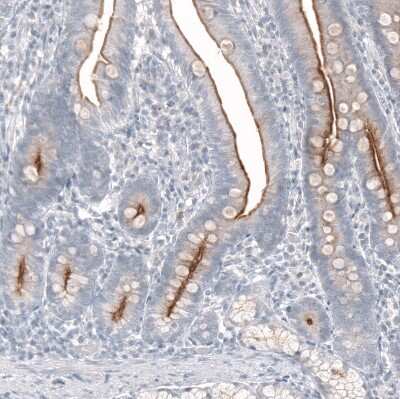 Immunohistochemistry-Paraffin: TMPRSS2 Antibody (CL12514) [NBP3-18539]
