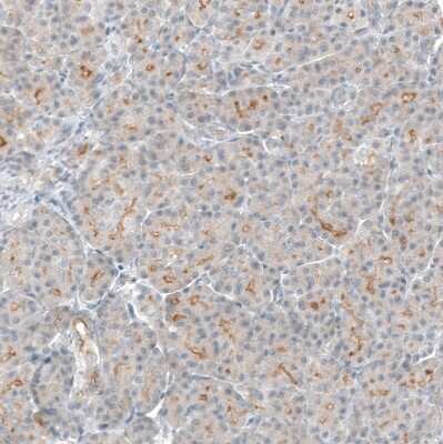 Immunohistochemistry-Paraffin: TMPRSS2 Antibody (CL12514) [NBP3-18539]