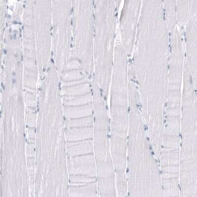 Immunohistochemistry-Paraffin: TMPRSS2 Antibody (CL12514) [NBP3-18539]
