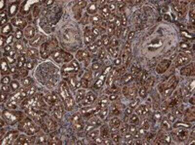 Immunohistochemistry-Paraffin: TMPRSS2 Antibody [NBP1-20984]