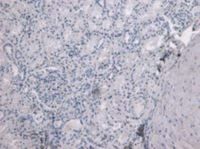 Immunohistochemistry-Paraffin: TMPRSS2 Antibody [NBP1-20984]