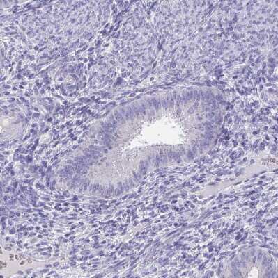 Immunohistochemistry-Paraffin: TMPRSS2 Antibody [NBP2-38263]