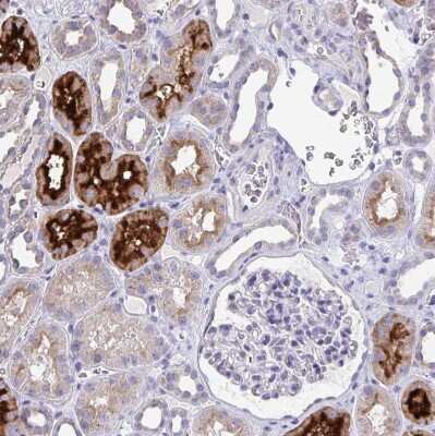 Immunohistochemistry-Paraffin: TMPRSS2 Antibody [NBP2-38263]