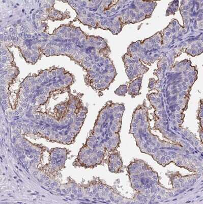 Immunohistochemistry-Paraffin: TMPRSS2 Antibody [NBP2-38263]