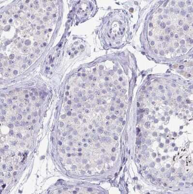 Immunohistochemistry-Paraffin: TMPRSS2 Antibody [NBP2-38263]