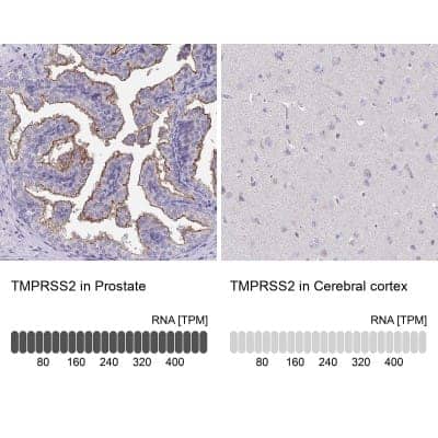 Immunohistochemistry-Paraffin: TMPRSS2 Antibody [NBP2-38263]