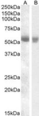 Western Blot: TMPRSS2 Antibody [NBP1-20984]