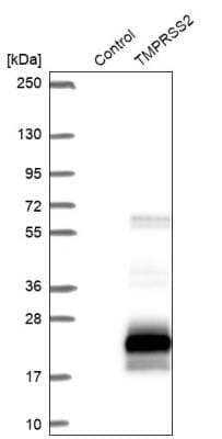 Western Blot: TMPRSS2 Antibody [NBP2-38263]