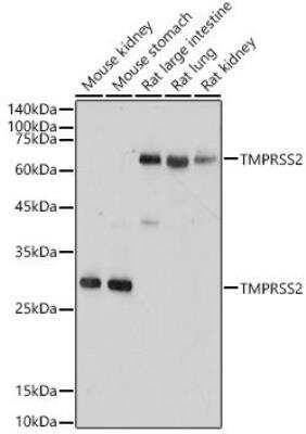 Western Blot: TMPRSS2 AntibodyAzide and BSA Free [NBP2-93322]