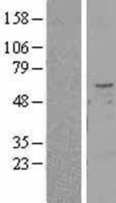 Western Blot: TMPRSS2 Overexpression Lysate [NBL1-17121]