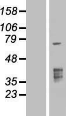 Western Blot: TMPRSS3 Overexpression Lysate [NBP2-06030]