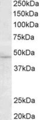 Western Blot: TMPRSS4 Antibody [NBP1-20985]