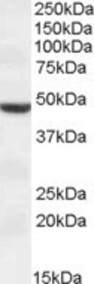 Western Blot: TMPRSS4 Antibody [NBP1-36997]