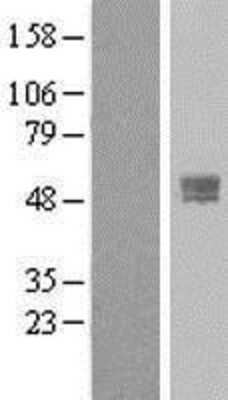 Western Blot: TMPRSS4 Overexpression Lysate [NBL1-17125]