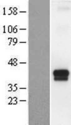 Western Blot: TMPRSS4 Overexpression Lysate [NBP2-04784]