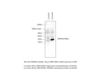 Western Blot: TMPRSS4 Overexpression Lysate [NBP2-04784]