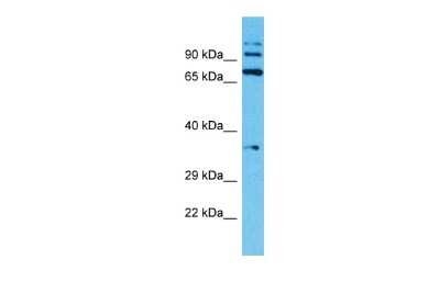 Western Blot: TMPRSS7 Antibody [NBP2-83702]