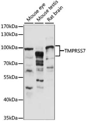 Western Blot: TMPRSS7 AntibodyAzide and BSA Free [NBP2-94598]