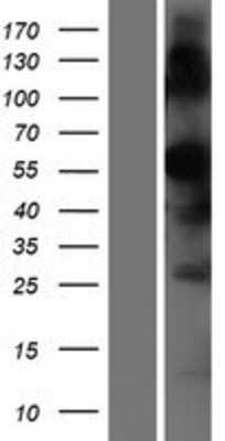 Western Blot: TMPRSS7 Overexpression Lysate [NBP2-08388]