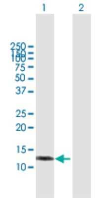 Western Blot: TMPRSS8 Antibody [H00124221-B01P]