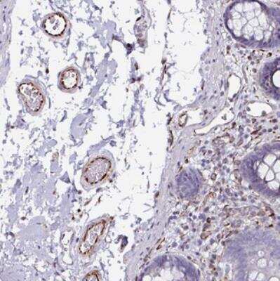 Immunohistochemistry-Paraffin: TMPRSS9 Antibody [NBP2-30892]