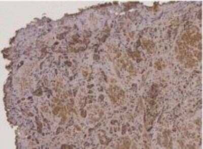 Immunohistochemistry: TMSB15B Antibody [NBP2-38054]