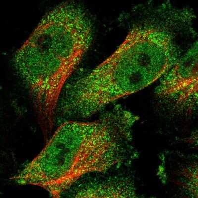 Immunocytochemistry/ Immunofluorescence: TMTC1 Antibody [NBP1-88837]