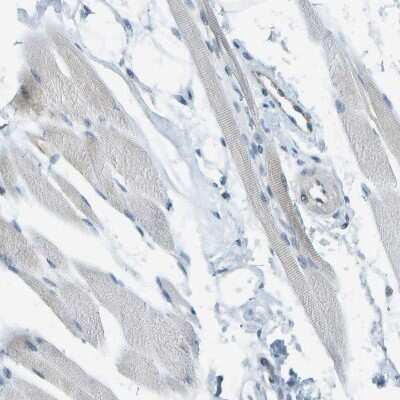 Immunohistochemistry-Paraffin: TMTC1 Antibody [NBP1-88837]