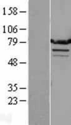 Western Blot: TMTC1 Overexpression Lysate [NBL1-17130]