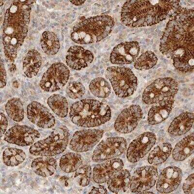 Immunohistochemistry-Paraffin: TMTC2 Antibody [NBP1-84093]