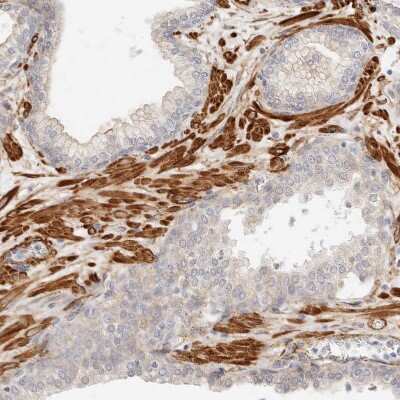Immunohistochemistry-Paraffin: TMTC2 Antibody [NBP1-85027]