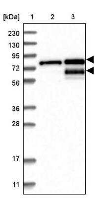 Western Blot: TMTC2 Antibody [NBP1-85027]