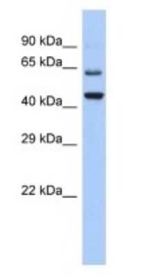 Western Blot: TMTC2 Antibody [NBP3-09267]